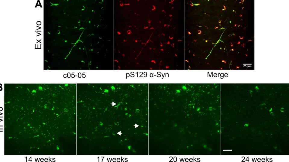 Images depicting ex-vivo and in vivo staining of aggregated alpha-synuclein in the cortex.