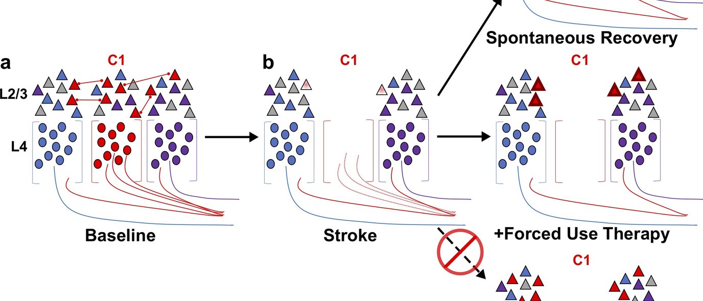 Image depicting sensory responses of neurons in the barrel cortex before and after stroke. Forced-use therapy potentiates responses in spared circuits, but does not promote remapping.