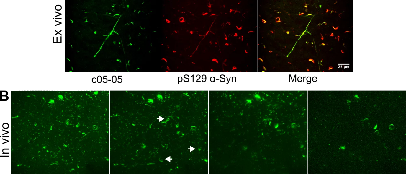 Images depicting ex-vivo and in vivo staining of aggregated alpha-synuclein in the cortex.