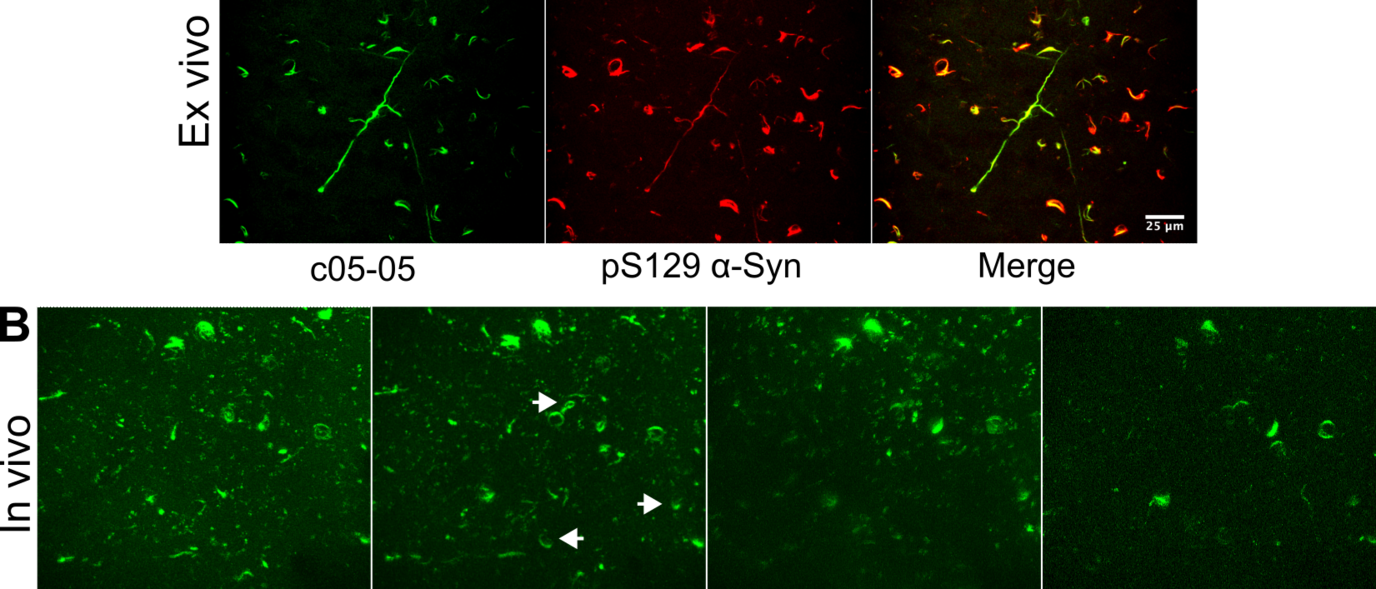 Images depicting ex-vivo and in vivo staining of aggregated alpha-synuclein in the cortex.